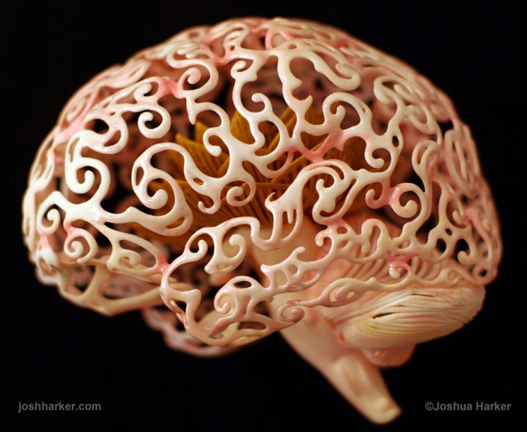 brain